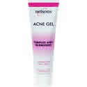 Acne Gel 30 gm from NELSON HOMEOPATHICS