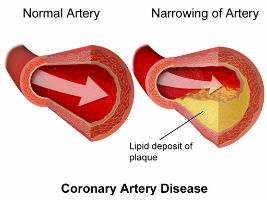 cholesterol